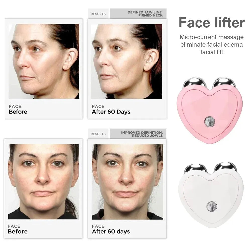 EMS Anti Wrinkle Microcurrent Roller Device
