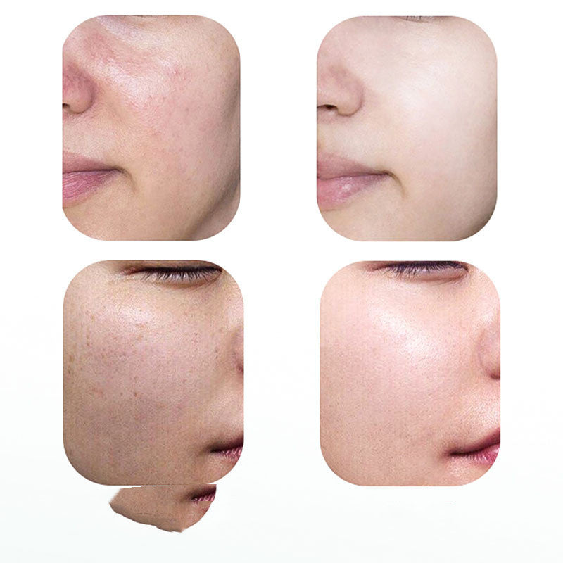 Face Beauty Photon Skin Mask